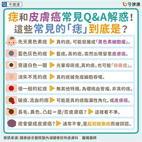 右耳朵突然長痣|是痣or皮膚癌？醫「1張圖秒對照」 長這2部位最危險